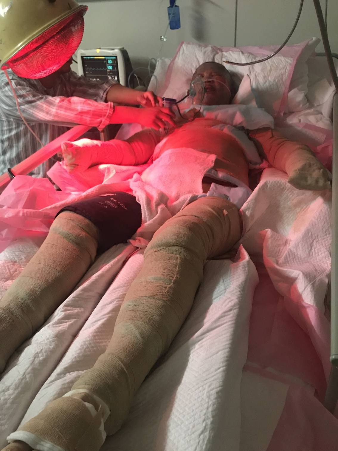 网红为燃气爆炸烧伤妈妈捐款30万，爱心与责任的体现