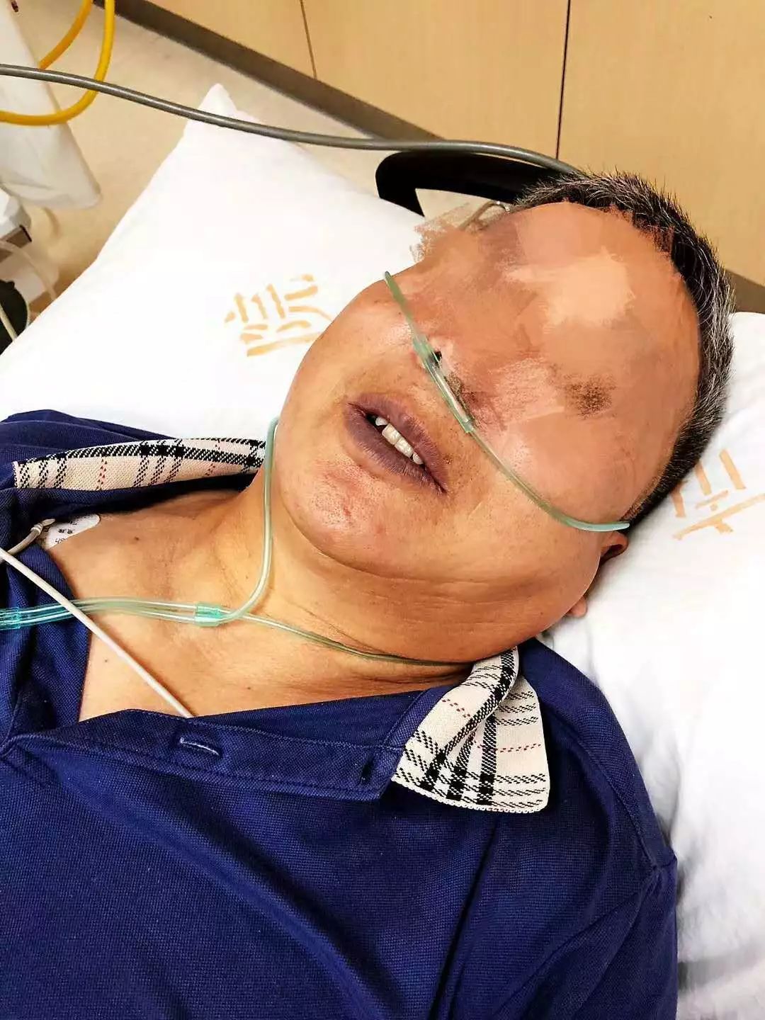 男子生食偏爱引发胆道虫患，自然美景成治愈之旅