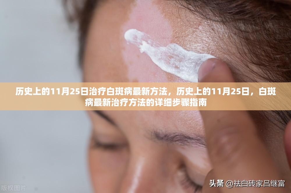 白斑病最新治疗技术解析✨