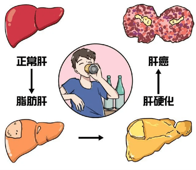 肝癌最新科研进展，温馨故事与科学突破共融探索