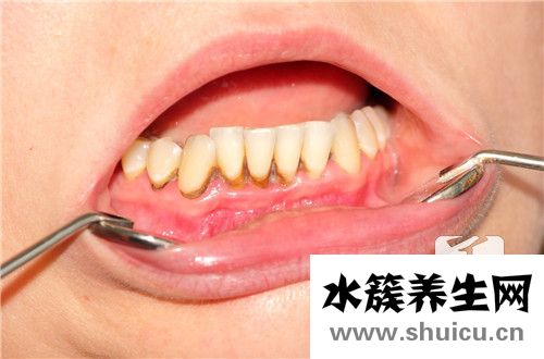 再生牙最新进展与步骤指南